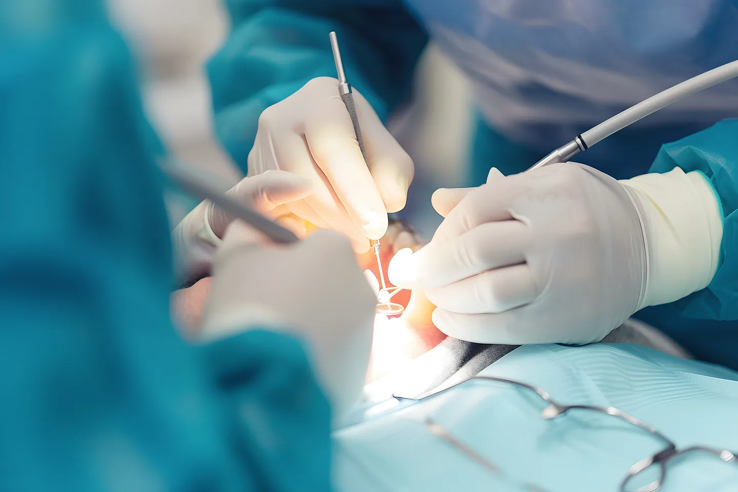 Ärzte während eines chirurgischen Eingriffs: Unsere professionelle Zahnchirurgie in Karlsruhe