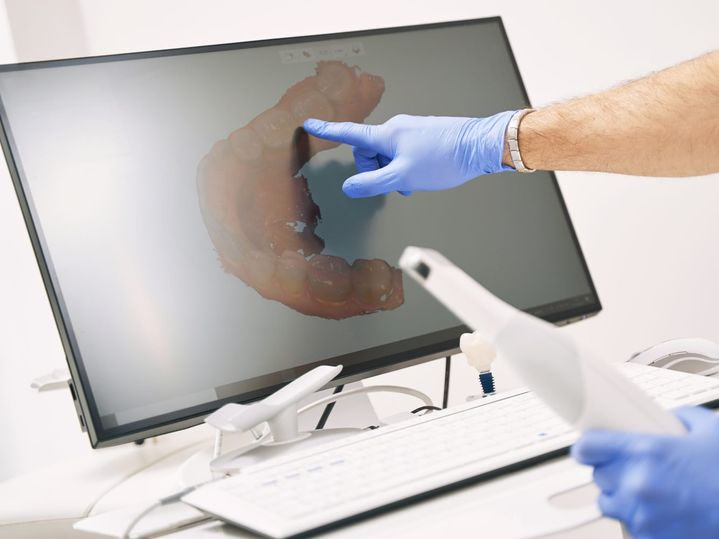 Modernste Implantologie in Karlsruhe dank 3D-Diagnostik.