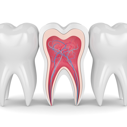  Eine professionelle Wurzelbehandlung ist bei einer Entzündung des Zahnnervs für die Zahnerhaltung unerlässlich. 
